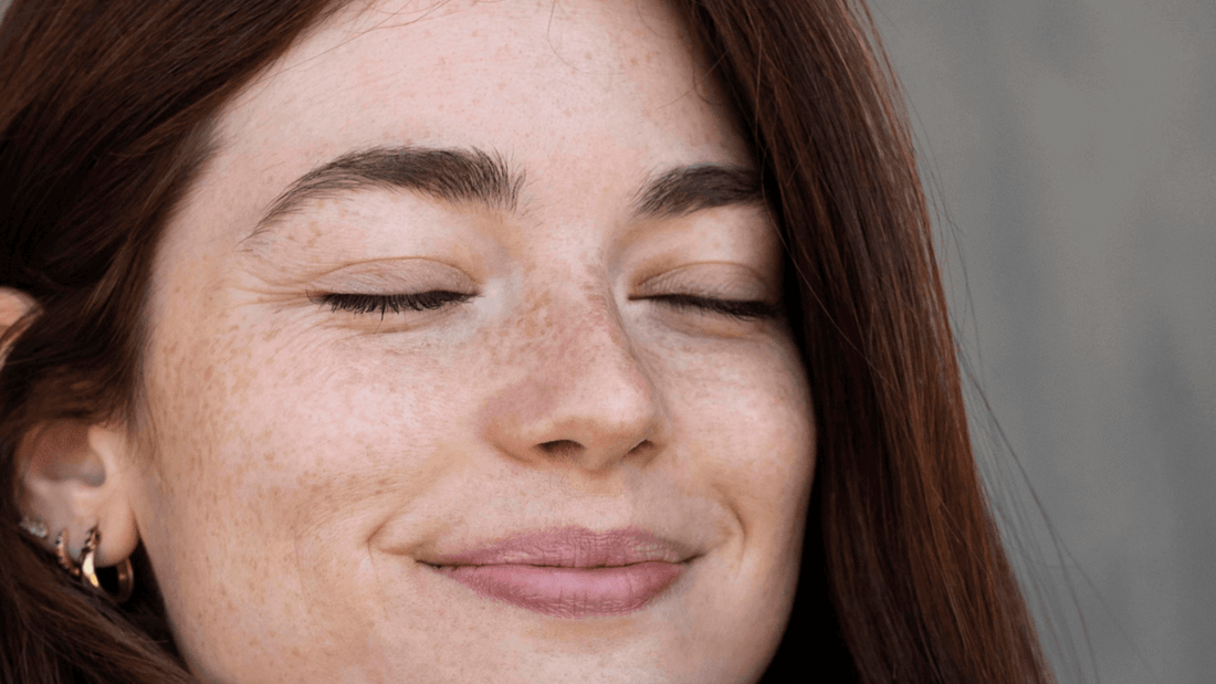 hyperpigmentation-types-treatments-and-cause